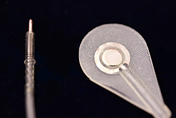 Epimysial (Unipolar) Stimulation Electrode
